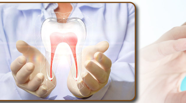 Root Canal Treatment