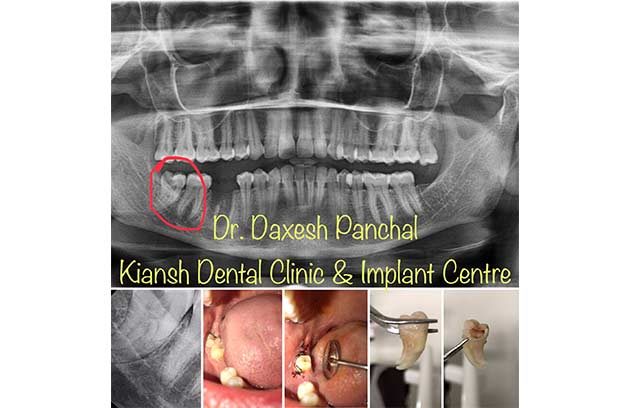 Kiansh Dental Clinic & Implant Centre